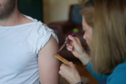 Applying Kambo to Gates or Burns